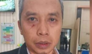 Advokat Jadi Korban Dugaan Penganiayaan di PA Panyabungan